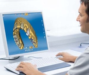 Come si fa un impianto dentale con chirurgia computer guidata